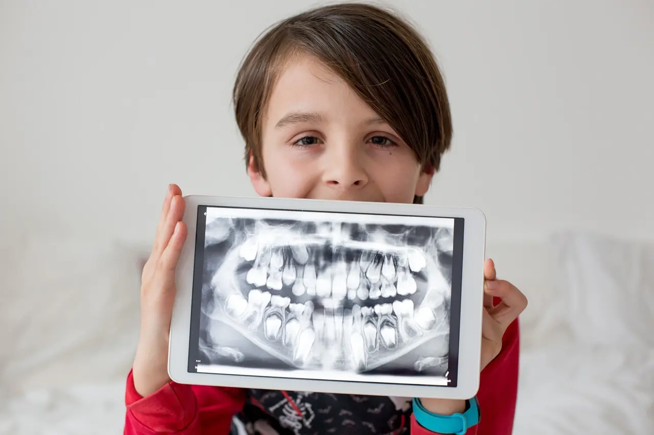 Exposición de Canino Impactado — Merrifield Oral Surgery